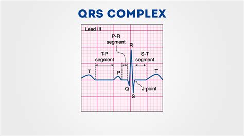 Understanding an ECG | Geeky Medics