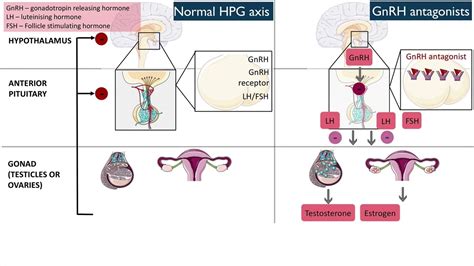 Gonadotropin-releasing hormone (GnRH) antagonists - YouTube