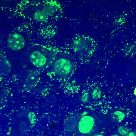 Mycoplasma Contamination In Cell Culture