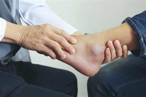 Do You Have A Case For A Missed Ankle Fracture? - The Thistle Law Firm