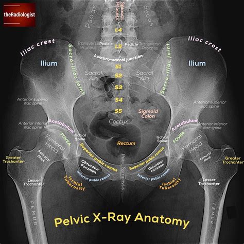 Please tag if you wish to share! ——— #theradiologist #radiology # ...