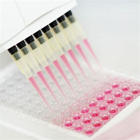 Multiplex Human Cytokine ELISA Kit (Th1/Th2/Th17)