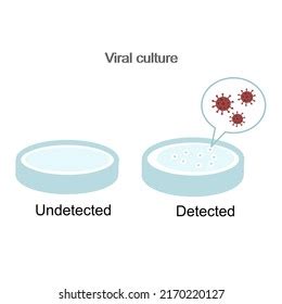 Result Interpretation Viral Culture Diagnosis Pathogen Stock Vector ...