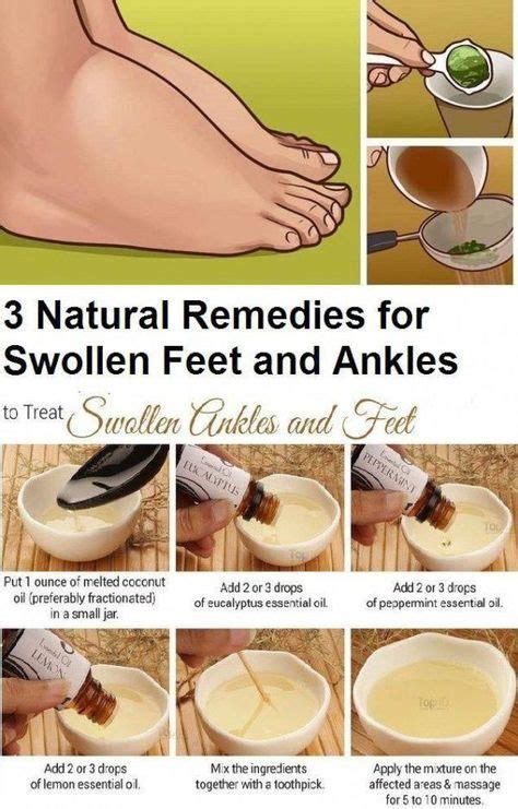 3 Natural Remedies For Swollen Ankles and Feet – FITNESS & FITNESS ...