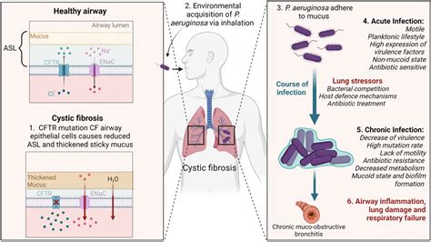 Frontiers | To bead or not to bead: A review of Pseudomonas aeruginosa ...