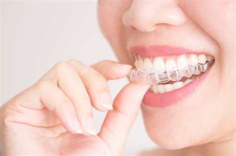 Straighten Your Teeth with Invisalign® Clear Aligners