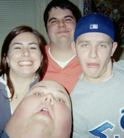 15 Weirdest Necks You Will Ever See – Page 5