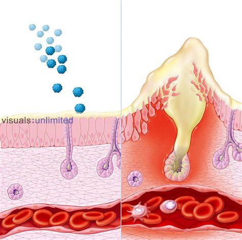 Biomedical illustration of healthy nasal mucous membrane coming into ...