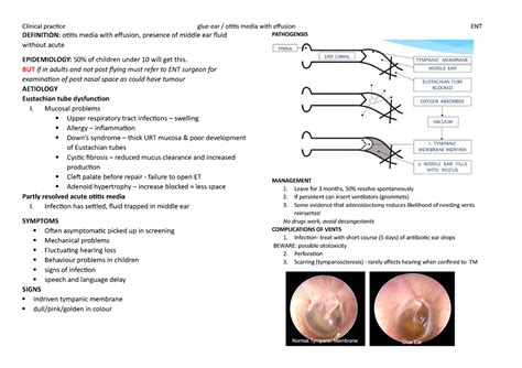 ENT: Glue ear - signs, symptoms and management - Clinical practice glue ...