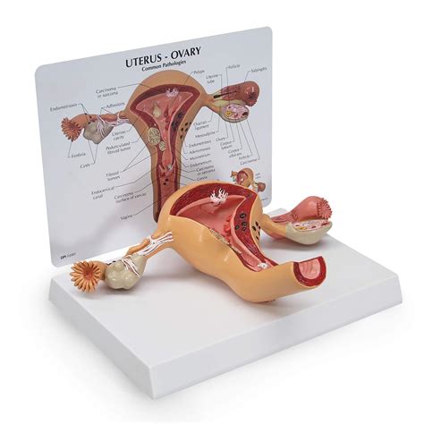 Buy Uterus and Ovary Model, Model of Female Reproductive System for ...