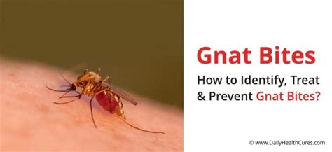 Gnat Bites: How to Identify and Treat Them? | Daily Health Cures