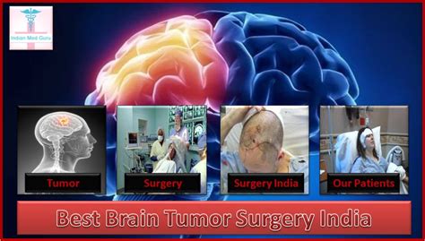 Who Needs Brain Tumor Surgery? - IndianMedguru