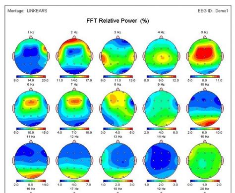 QEEG: 3 Ways a Brain Map Can Help - Denver Englewood Counseling ...