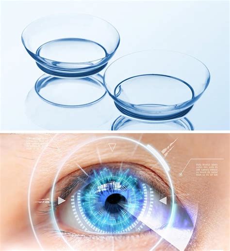 Orthokeratology Visual Stress Coloured Lenses Hypersensitive Eyes ...