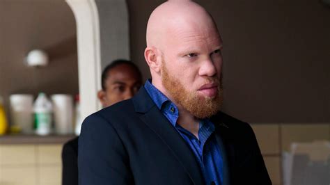 Black Lightning's Tobias Is TV's First Villain With Albinism - TV Guide