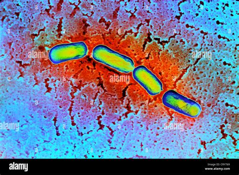 Clostridia Stock Photos & Clostridia Stock Images - Alamy