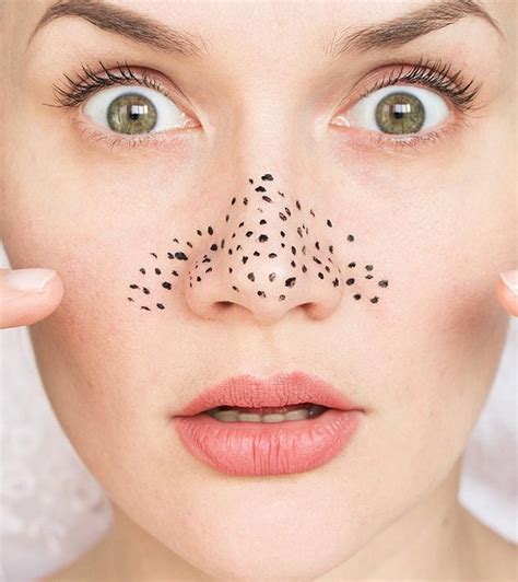 8 Super Simple Tips To Remove Blackheads On Nose Immediately - StarBiz.com