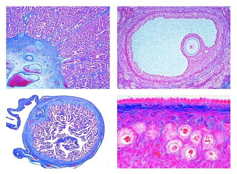 Reproductive System: Medical Anatomy and Histology of Male vs Female ...