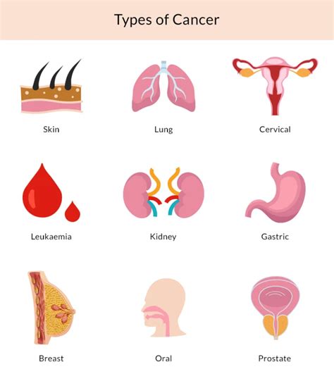 Cancer: Common Causes, Symptoms, Types, Cancer Care Plan