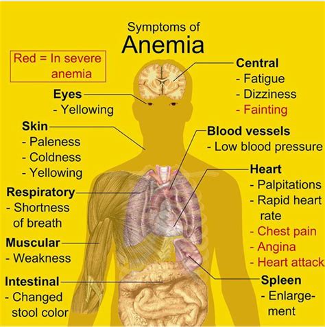 Symptoms of Anemia - MEDizzy