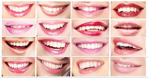 The Three Types of Smiles - West Palm Beach Dentist