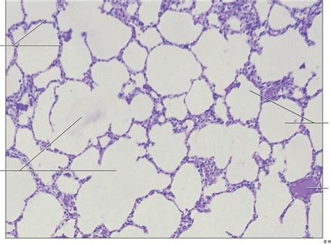 Alveolar Epithelium Histology