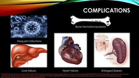 PPT - THALASSEMIA PowerPoint Presentation, free download - ID:5780465