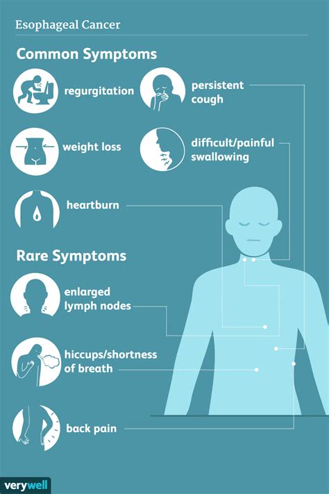 Esophageal Cancer: Signs and Symptoms