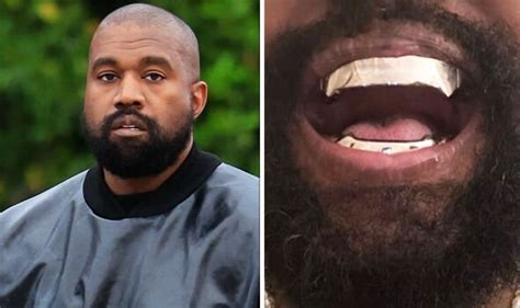 Kanye West has Bond villain transformation with metal teeth that cost ...