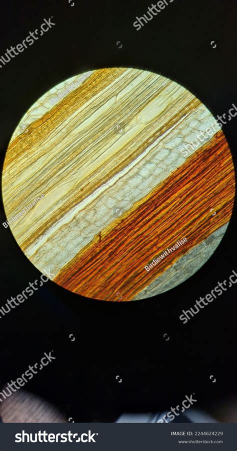 Bracken Rhizome Structure Under Microscope Stock Photo 2244624229 ...