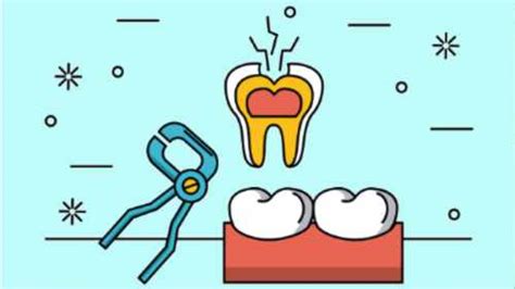 Tooth Extraction Complications | Teethstars.com