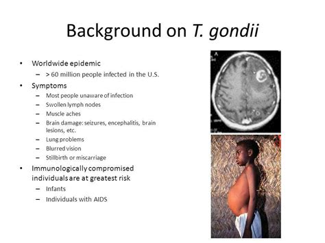 Toxoplasma Gondii In Humans Symptoms