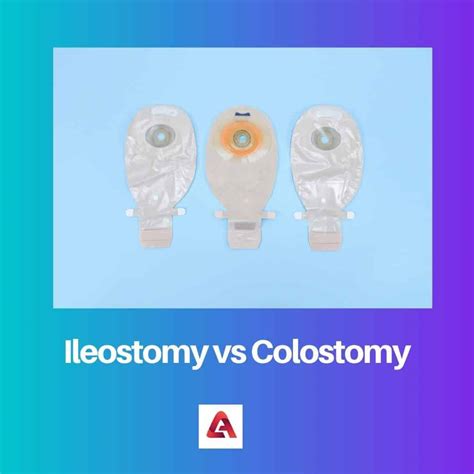 Difference Between Ileostomy and Colostomy (2023)