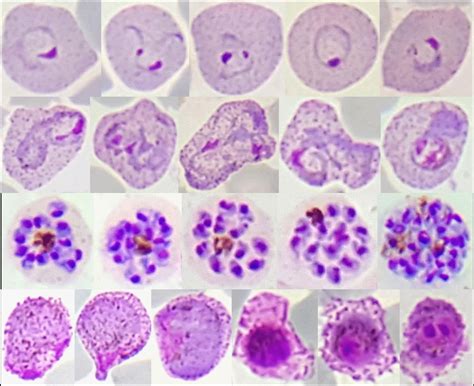 Gene sequences reveal global variations in malaria parasites ...