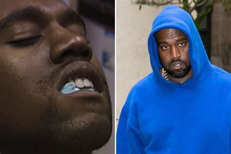 Kanye West has jaw wired shut in agonising first look at Netflix ...