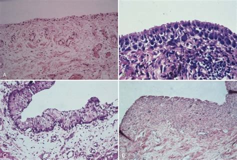 Synovial Membrane Histology