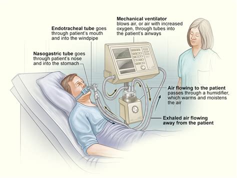 Ventilator/Ventilator Support - What Is a Ventilator? | NHLBI, NIH