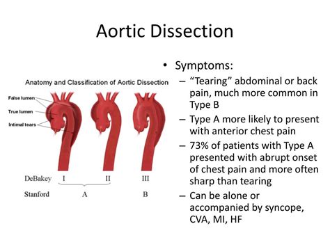 Irad dissection - apospot