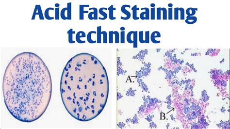 Acid Fast Staining| Differentiate acid and non-acid fast bacteria # ...