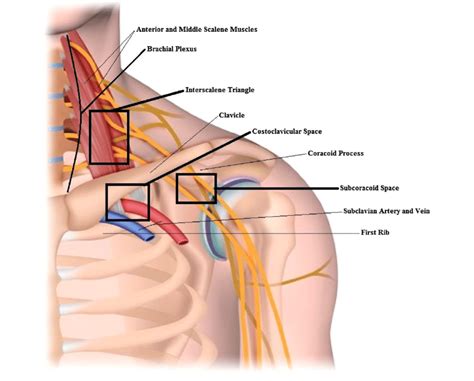 Thoracic outlet and relevant anatomy | Download Scientific Diagram