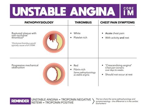 Unstable Angina | Core IM Podcast