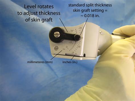 Split Thickness Skin Graft Thickness Dermatome Settings