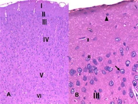 Showing six layers of cerebral cortex of control group; molecular layer ...