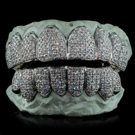 Real Diamonds Round Diamond Teeth Grillz, Weight: Custom