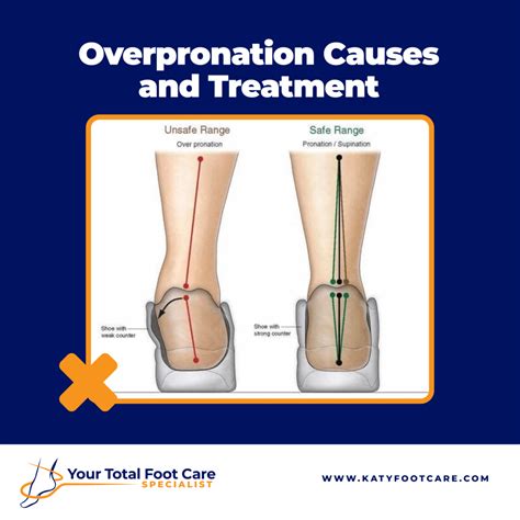 Overpronation Causes and treatment