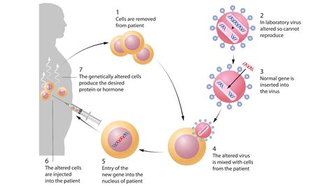 Gene therapy: What is it and how does it work? | Live Science