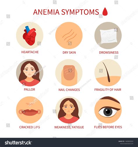 1,701 Symptoms Anemia Images, Stock Photos & Vectors | Shutterstock