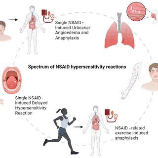 Spectrum of NSAID hypersensitivity reactions. Aspirin-exacerbated ...