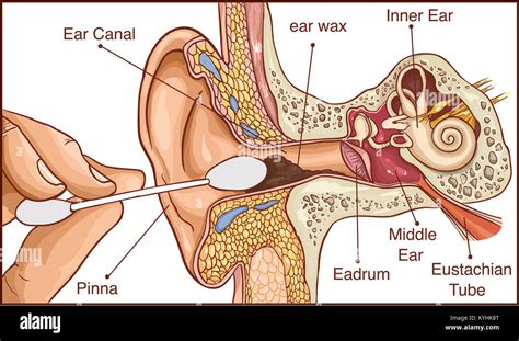 Section of the ear with the earwax - colorful diagram Stock Vector ...