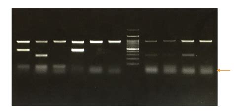 "Primer Dimer": Zones DNA amplification by pairing with foe